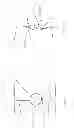 Fig. 02 - Seamless-vision, tilted intraocular lens