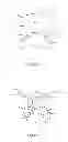 Fig. 07 - Seamless-vision, tilted intraocular lens