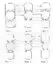 Fig. 10 - Seamless-vision, tilted intraocular lens
