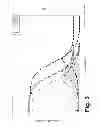 Fig. 04 - Shape memory polymer intraocular lenses