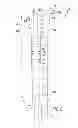 Fig. 03 - Tissue graft anchor assembly and instrumentation for use therewith