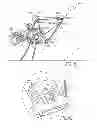 Fig. 17 - Tissue graft anchor assembly and instrumentation for use therewith