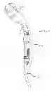 Fig. 01 - Extra-articular implantable mechanical energy absorbing systems and implantation method