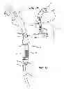 Fig. 08 - Extra-articular implantable mechanical energy absorbing systems and implantation method