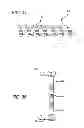 Fig. 21 - Extra-articular implantable mechanical energy absorbing systems and implantation method