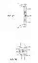 Fig. 22 - Extra-articular implantable mechanical energy absorbing systems and implantation method