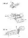 Fig. 24 - Extra-articular implantable mechanical energy absorbing systems and implantation method