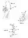 Fig. 28 - Extra-articular implantable mechanical energy absorbing systems and implantation method