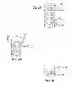 Fig. 33 - Extra-articular implantable mechanical energy absorbing systems and implantation method