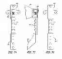 Fig. 37 - Extra-articular implantable mechanical energy absorbing systems and implantation method