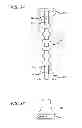 Fig. 38 - Extra-articular implantable mechanical energy absorbing systems and implantation method