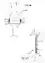 Fig. 42 - Extra-articular implantable mechanical energy absorbing systems and implantation method