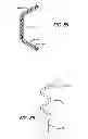 Fig. 43 - Extra-articular implantable mechanical energy absorbing systems and implantation method