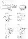 Fig. 45 - Extra-articular implantable mechanical energy absorbing systems and implantation method