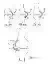 Fig. 48 - Extra-articular implantable mechanical energy absorbing systems and implantation method