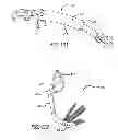 Fig. 58 - Extra-articular implantable mechanical energy absorbing systems and implantation method