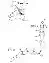 Fig. 60 - Extra-articular implantable mechanical energy absorbing systems and implantation method