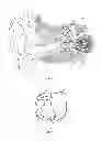Fig. 03 - Techniques For Increasing The Acoustic Impedance Of The Cochlea's Round Window Membrane