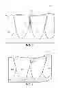 Fig. 02 - Creating a digital dental model of a patient's teeth using interproximal information