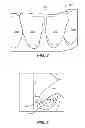 Fig. 03 - Creating a digital dental model of a patient's teeth using interproximal information