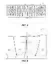 Fig. 04 - Creating a digital dental model of a patient's teeth using interproximal information