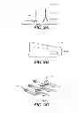 Fig. 07 - Creating a digital dental model of a patient's teeth using interproximal information