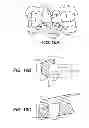 Fig. 09 - Creating a digital dental model of a patient's teeth using interproximal information