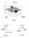 Fig. 02 - VISUALIZATION FOR HEALTH EDUCATION TO FACILITATE PLANNING FOR INTERVENTION, ADAPTATION AND ADHERENCE