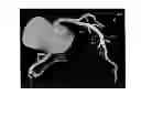 Fig. 06 - Method and system for providing information from a patient-specific model of blood flow