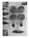Fig. 02 - Peach Tree Named 'Ice Queen'