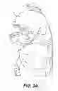 Fig. 06 - Cervical spine protection apparatus and methods of use