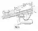 Fig. 07 - PATIENT POSITIONING SYSTEM