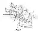 Fig. 08 - PATIENT POSITIONING SYSTEM