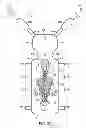 Fig. 35 - PATIENT POSITIONING SYSTEM