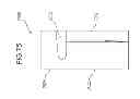 Fig. 40 - Therapeutic cushion systems and methods