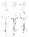 Fig. 05 - METHOD FOR PRODUCING A TOOTHBRUSH, AND TOOTHBRUSH