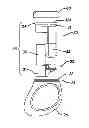 Fig. 01 - METHODS OF MAKING ELECTROMECHANICAL PERSONAL CARE DEVICE