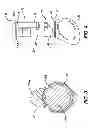 Fig. 03 - METHODS OF MAKING ELECTROMECHANICAL PERSONAL CARE DEVICE