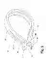 Fig. 03 - Device for removing earrings