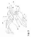 Fig. 04 - Device for removing earrings