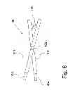 Fig. 07 - Device for removing earrings