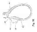 Fig. 17 - Device for removing earrings