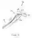 Fig. 11 - Hair trimmer with cutting guide