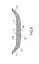 Fig. 06 - FOOTBED AND METHOD FOR MAKING THE SAME
