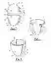 Fig. 04 - COLLAPSIBLE AND/OR ERECTABLE SUBSTANTIALLY EGG-SHAPED CONTAINER AND METHODS OF USE THEREOF