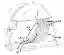 Fig. 01 - Concave with crop guidance features