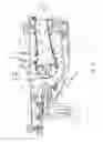 Fig. 03 - REPAIR PROCEDURE FOR A GAS TURBINE ENGINE VIA VARIABLE POLARITY WELDING