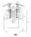 Fig. 09 - Hotstick assembly for installing and removing devices from high voltage energized overhead power lines
