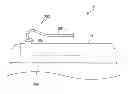 Fig. 01 - PCV valve apparatus