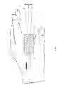 Fig. 03 - Pivotal handle for archery bow